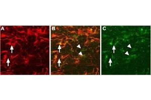 Expression of proNGF in rat brain sections - Immunohistochemical staining of proNGF in rat brain sections using Anti-proNGF Antibody (ABIN7043556, ABIN7044751 and ABIN7044752). (Nerve Growth Factor Antikörper  (Pro-Domain))