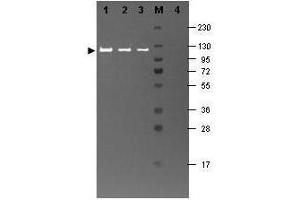 Western blotting using  Fluorescein conjugated anti-b-Galactosidase antibody shows a band at ~117 kDa (lanes 1 - 3) corresponding to 60 ng, 30 ng and 15 ng, respectively of b-Gal present in partially purified preparations (arrowhead). (GLB1 Antikörper  (FITC))