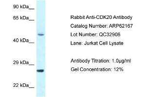 Western Blotting (WB) image for anti-Cyclin-Dependent Kinase 20 (CDK20) (N-Term) antibody (ABIN2789044)