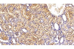 Immunohistochemistry (IHC) image for anti-Transferrin (TF) (AA 361-683) antibody (ABIN7429184)