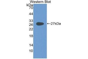 Western Blotting (WB) image for anti-Glycoprotein 2 (Zymogen Granule Membrane) (GP2) (AA 307-512) antibody (ABIN2118694) (GP2 Antikörper  (AA 307-512))