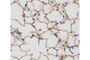 IHC testing of FFPE mouse lung tissue with Csf1r antibody at 1:25 dilution. (CSF1R Antikörper  (AA 895-923))
