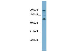 WB Suggested Anti-ZNF662 Antibody Titration:  0. (ZNF662 Antikörper  (Middle Region))