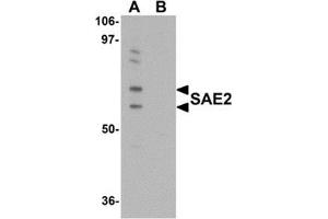 Western blot analysis of SAE2 in 293 cell lysate with SAE2 antibody at 0. (UBA2 Antikörper  (C-Term))
