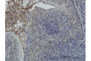 Immunoperoxidase of monoclonal antibody to RPS6KA6 on formalin-fixed paraffin-embedded human tonsil. (RPS6KA6 Antikörper  (AA 636-745))