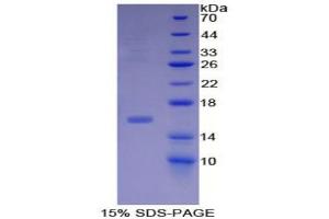 SDS-PAGE analysis of Human Inhibin beta B Protein. (INHBB Protein)
