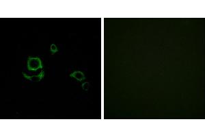 Peptide - +Immunohistochemistry analysis of paraffin-embedded human heart tissue using F13B antibody. (F13B Antikörper)
