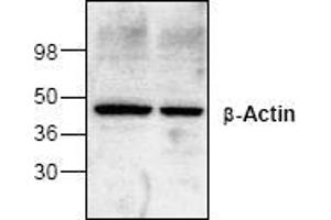 Image no. 1 for anti-Actin, beta (ACTB) antibody (ABIN127292)