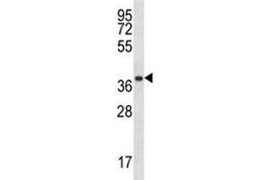 PSMA1 antibody western blot analysis in A2058 lysate. (PSMA1 Antikörper  (AA 234-262))