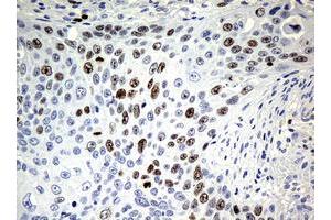 Image no. 1 for anti-Antigen Identified By Monoclonal Antibody Ki-67 (MKI67) (AA 1160-1493) antibody (ABIN1490857) (Ki-67 Antikörper  (AA 1160-1493))