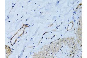Immunohistochemistry of paraffin-embedded human colon using MCAM antibody (ABIN6290150) at dilution of 1:100 (40x lens). (MCAM Antikörper)