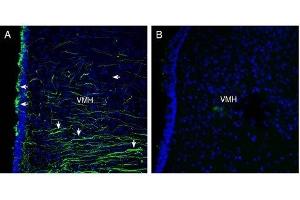 Expression of Semaphorin 4A in rat hypothalamus - Immunohistochemical staining of perfusion-fixed frozen rat brain sections with Anti-Semaphorin 4A (SEMA4A) (extracellular) Antibody (ABIN7043610, ABIN7045300 and ABIN7045301), (1:300), followed by goat anti-rabbit-Alexa-488. (Sema4a Antikörper  (Extracellular, N-Term))