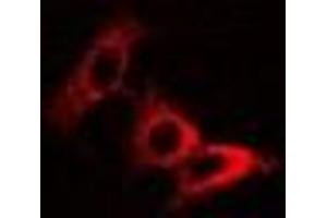 Immunofluorescent analysis of Pyridoxal Kinase staining in U2OS cells. (PDXK Antikörper)