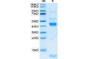Rhesus macaque Latent TGF beta 1 on Tris-Bis PAGE under reduced condition. (Latent TGF-beta 1 protein (His tag))