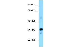 WB Suggested Anti-Nrbf2 Antibody Titration: 1. (NRBF2 Antikörper  (N-Term))