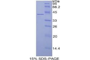 SDS-PAGE analysis of Human Histone Cluster 3, H2a Protein. (HIST3H2A Protein)