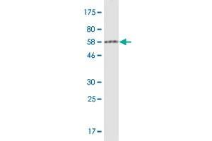 Western Blotting (WB) image for anti-Protein Arginine Methyltransferase 6 (PRMT6) (AA 1-316) antibody (ABIN949428)
