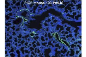 Immunofluorescence staining (green) of mouse lung tissue (ED18) with anti-Mouse PlGF Antibody Cat. (PLGF Antikörper  (AA 24-158))