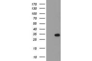 HEK293T cells were transfected with the pCMV6-ENTRY control (Left lane) or pCMV6-ENTRY RFXANK (Right lane) cDNA for 48 hrs and lysed. (RFXANK Antikörper)