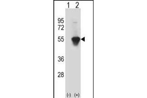 Western blot analysis of MINA (arrow) using rabbit polyclonal MINA Antibody (C-term) (ABIN387880 and ABIN2844089).