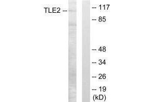 Western blot analysis of extracts from LOVO cells, using TLE2 antibody. (TLE2 Antikörper)