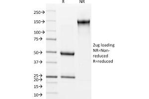 SDS-PAGE (SDS) image for anti-Keratin 15 (KRT15) antibody (ABIN6939913)