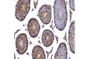 IHC analysis of HGS using anti-HGS antibody (ABIN7601206). (HGS Antikörper  (AA 3-777))