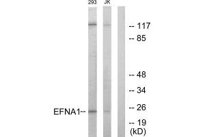 Western blot analysis of extracts from 293 cells and Jurkat cells, using EFNA1 antibody. (Ephrin A1 Antikörper  (Internal Region))
