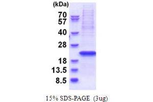 SDS-PAGE (SDS) image for Yip1 Interacting Factor Homolog B (YIF1B) (AA 1-156) protein (His tag) (ABIN5853712)