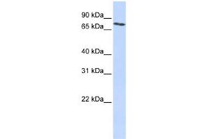 WB Suggested Anti-SLCO2B1 Antibody Titration:  0. (SLCO2B1 Antikörper  (N-Term))