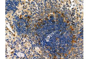ABIN6261515 and ABIN6278456 at 1/100 staining Rat spleen tissue by IHC-P. (ELMO1 Antikörper  (C-Term))