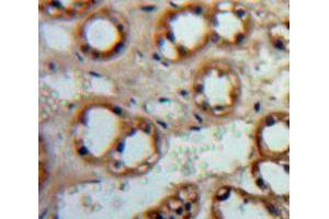 IHC-P analysis of Adrenal tissue, with DAB staining. (ADCY1 Antikörper  (AA 835-1061))