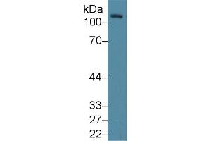 Western Blotting (WB) image for anti-PTK2 Protein tyrosine Kinase 2 (PTK2) (AA 798-1041) antibody (ABIN7439699)
