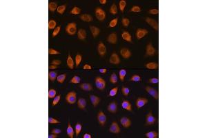 Immunofluorescence analysis of L929 cells using SEL1L antibody (ABIN6132642, ABIN6147499, ABIN6147500 and ABIN6215644) at dilution of 1:100. (SEL1L Antikörper  (AA 22-190))