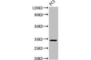 Western Blot Positive WB detected in: PC-3 whole cell lysate All lanes: STX1A antibody at 3 μg/mL Secondary Goat polyclonal to rabbit IgG at 1/50000 dilution Predicted band size: 34, 30, 29 kDa Observed band size: 34 kDa (STX1A Antikörper  (AA 1-265))