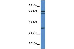 WB Suggested Anti-Terf2ip Antibody Titration: 1. (RAP1 Antikörper  (Middle Region))
