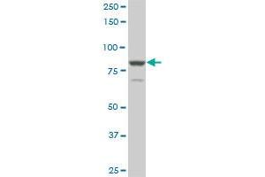 Western Blotting (WB) image for anti-Transforming, Acidic Coiled-Coil Containing Protein 3 (TACC3) (AA 1-101) antibody (ABIN6745991) (TACC3 Antikörper  (AA 1-101))