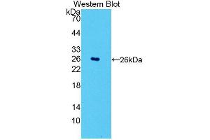 Western blot analysis of the recombinant protein. (POMT1 Antikörper  (AA 318-513))