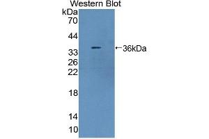 Western blot analysis of the recombinant protein. (TLR8 Antikörper  (AA 519-812))