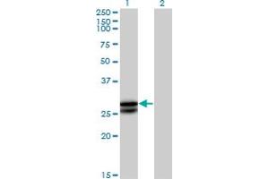 Western Blot analysis of OSM expression in transfected 293T cell line by OSM MaxPab polyclonal antibody. (Oncostatin M Antikörper  (AA 1-252))