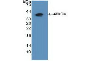 Western blot analysis of recombinant Human NFkB. (NFkB Antikörper  (AA 805-892))
