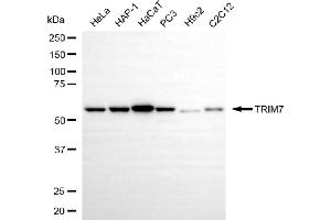 Western blotting analysis using TRIM7 antibody (ABIN7800643). (TRIM7 Antikörper)