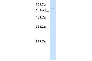 WB Suggested Anti-CTPS Antibody Titration:  5. (CTP Synthase Antikörper  (C-Term))