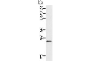 Gel: 10 % SDS-PAGE, Lysate: 40 μg, Lane: Human heart tissue, Primary antibody: ABIN7192155(RBM38 Antibody) at dilution 1/200, Secondary antibody: Goat anti rabbit IgG at 1/8000 dilution, Exposure time: 1 minute (RBM38 Antikörper)