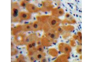 Used in DAB staining on fromalin fixed paraffin-embedded Liver tissue (CSTB Antikörper  (AA 1-98))