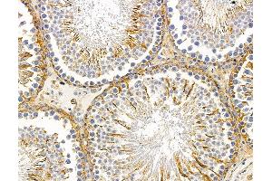 ABIN7095914 and ABIN7099976 at 1/100 staining rat testis tissue by IHC-P. (CCSER1 Antikörper)