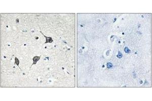 Immunohistochemistry analysis of paraffin-embedded human brain tissue, using GPR20 Antibody.