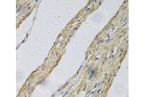 Immunohistochemistry of paraffin-embedded Human smooth muscle using PRNP Polyclonal Antibody at dilution of 1:100 (40x lens). (PRNP Antikörper)
