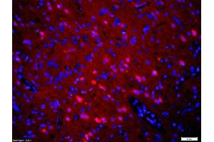 Formalin-fixed and paraffin embedded rat brain labeled with Rabbit Anti-5HT2A Receptor/SR-2A Polyclonal Antibody, Unconjugated at 1:200 followed by conjugation to the secondary antibody, Goat Anti-Rabbit IgG, Cy3 conjugated used at 1:200 dilution for 40 minutes at 37 °C. (HTR2A Antikörper  (AA 51-150))