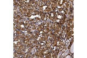 IHC analysis of KLHL12 using anti-KLHL12 antibody (ABIN7601009).